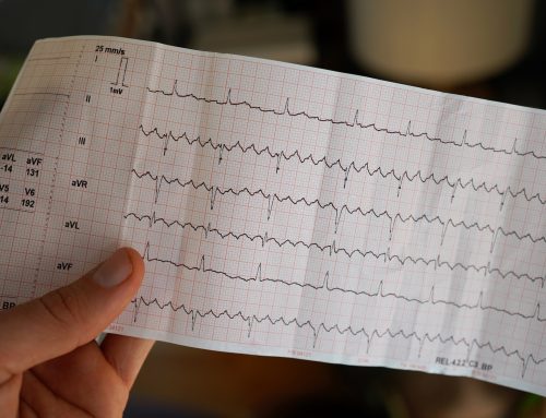 Κολπική Μαρμαρυγή: Μια συχνή καρδιακή αρρυθμία με σημαντικές κλινικές επιπτώσεις
